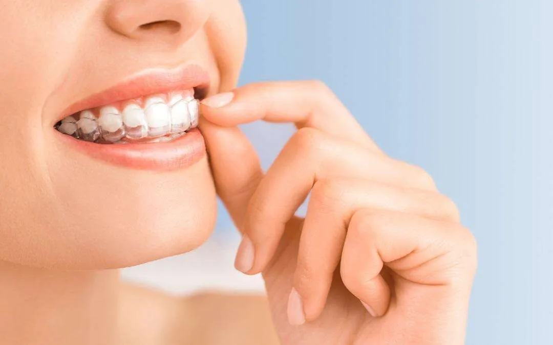 ¡5 Razones para olvidar los Brackets y elegir Wizz!
