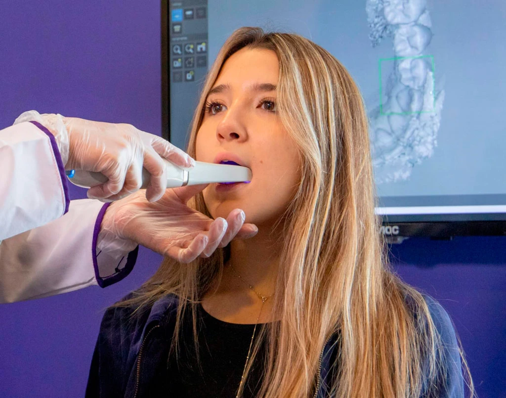 escáner en cita para alineadores invisbles