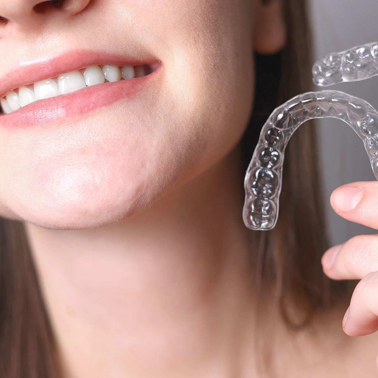 ¿Cuál es el costo de la ortodoncia Invisalign en Chile?