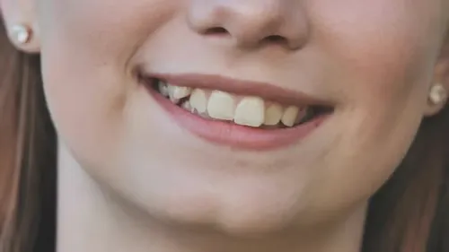 Transforma la sonrisa de tus hijos… ¡sin que nadie lo note!