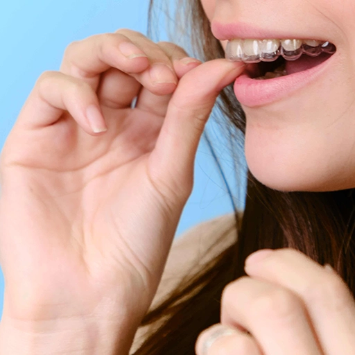 La ortodoncia que podría dejar obsoletos a los brackets