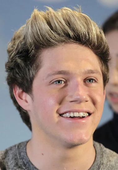 Niall Horan utilizando brackets estéticos