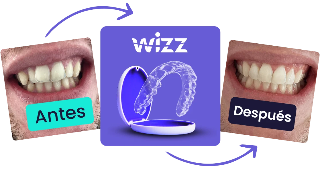 Alineadores invisibles antes y después