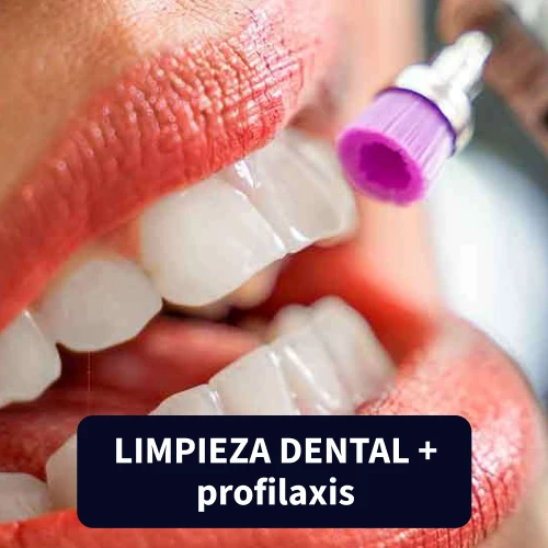 Limpieza Dental