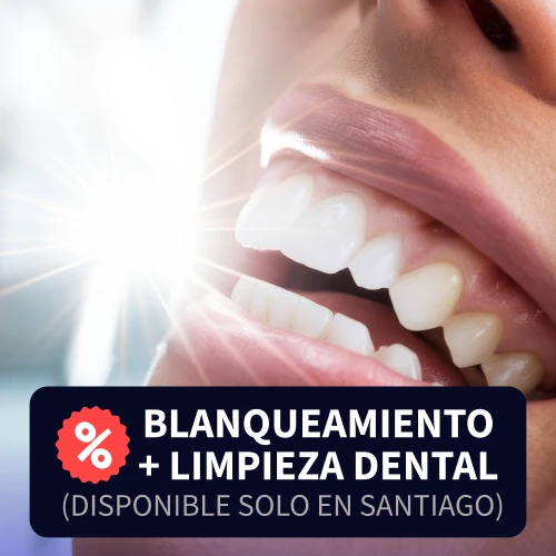 Blanqueamiento + Limpieza Dental
