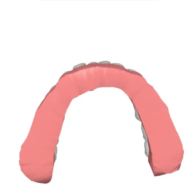 Tratamiento virtual de paciente Wizz